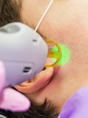 A medical specialist in pink gloves performs a laser hair removal procedure on the temporal region of a young person on the right side